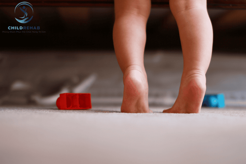 Trẻ Đi Bằng Mũi Chân: Nguyên Nhân & Cách Can Thiệp 2026 | ChildRehab