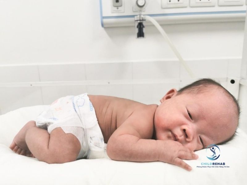 Phục Hồi Hô Hấp Cho Trẻ Sinh Non 2026 | ChildRehab