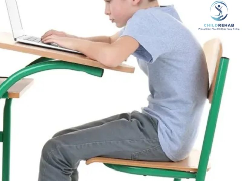 Cong Vẹo Cột Sống Ở Trẻ 10 Tuổi Và Những Dấu Hiệu Không Nên Bỏ Qua 2026 | ChildRehab