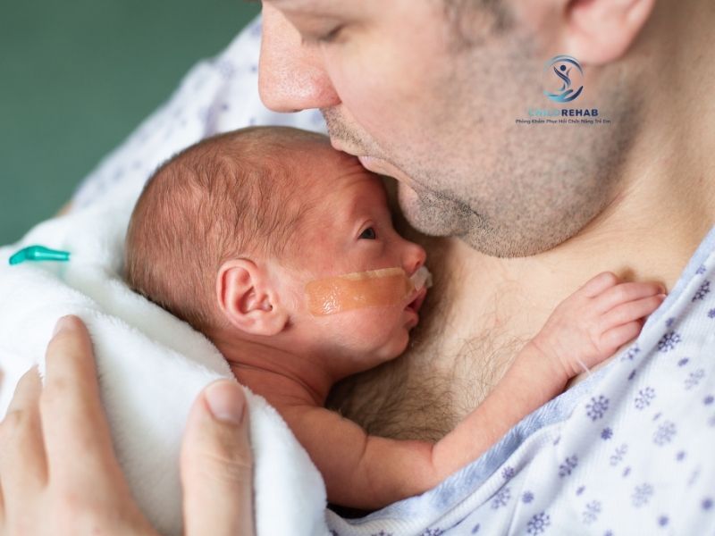 Trẻ Sinh Non Có Dễ Chậm Phát Triển Vận Động? 2026 | ChildRehab