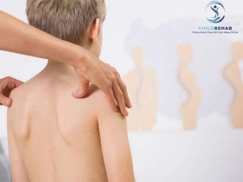 Gù Lưng Ở Trẻ Có Ảnh Hưởng Đến Dáng Đứng Và Phát Triển Vận Động Không? 2026 | ChildRehab