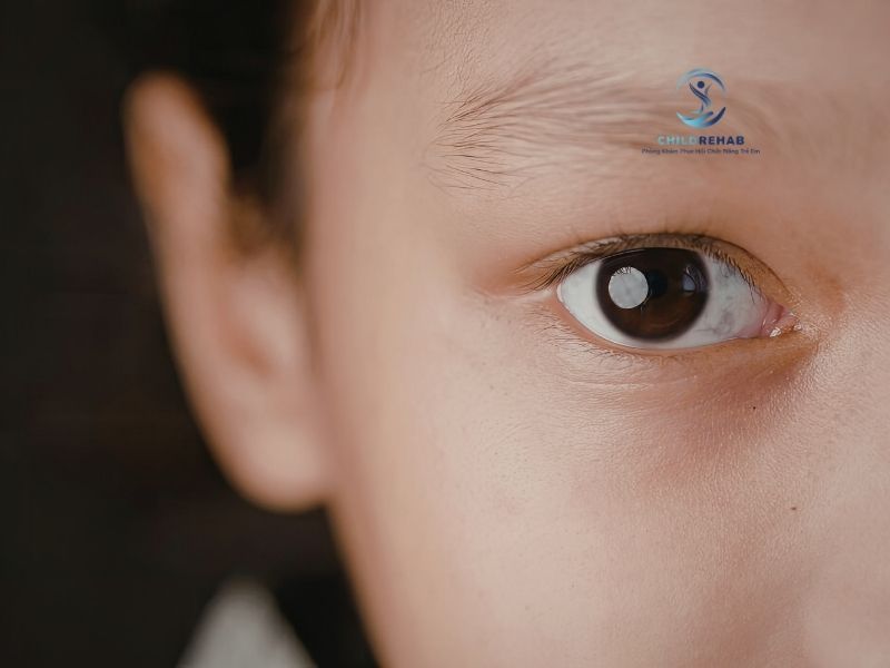 Trẻ Không Giao Tiếp Mắt Có Phải Dấu Hiệu Bất Thường Không? 2026 | ChildRehab