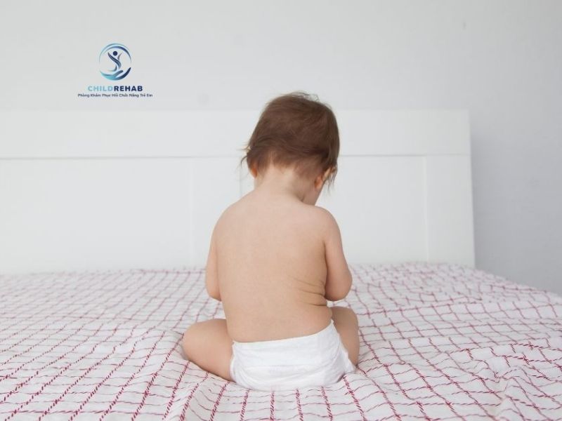 Trẻ Bị Gù Lưng Nhẹ Có Cần Lo Không? 2026 | ChildRehab