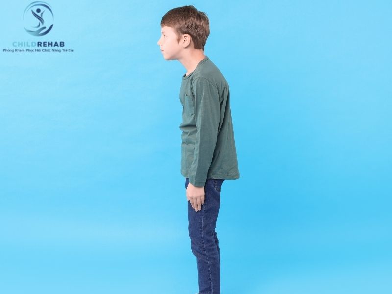 Yếu Cơ Tư Thế Có Phải Là Nguyên Nhân Gây Gù Lưng Ở Trẻ Không? 2026 | ChildRehab