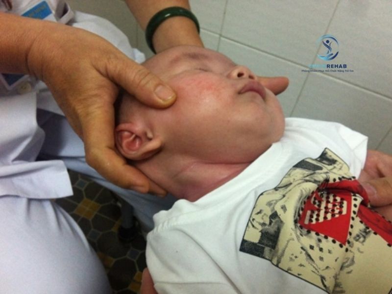 Bài Tập Cho Trẻ Bị Vẹo Cổ Tại Nhà Hiệu Quả 2026 | ChildRehab