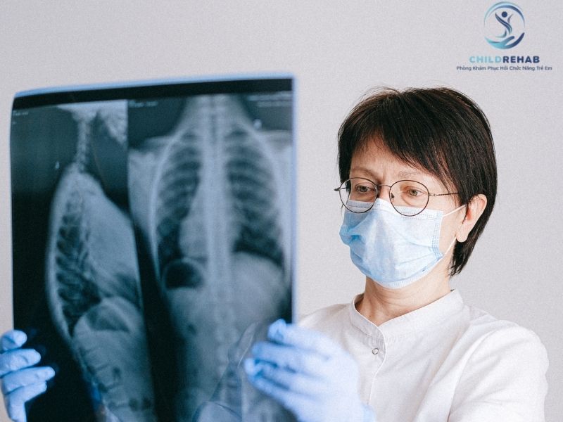 Trẻ Bị Gù Lưng Có Cần Chụp X-Quang Không? 2026 | ChildRehab