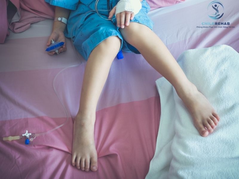 Chân Trẻ Không Thẳng Có Sao Không? Khi Nào Là Bình Thường, Khi Nào Cần Lo 2026 | ChildRehab