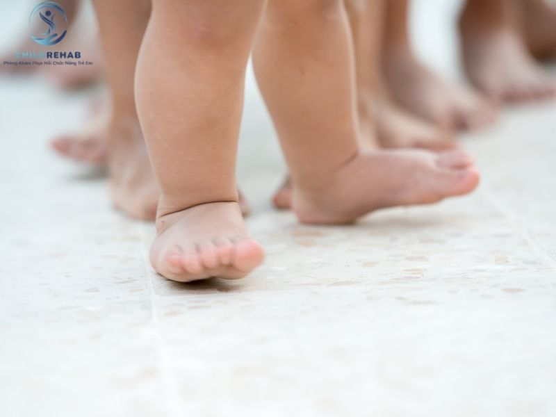 Lệch Trục Chi Dưới Có Ảnh Hưởng Đến Dáng Đi Và Vận Động Của Trẻ Không? 2026 | ChildRehab