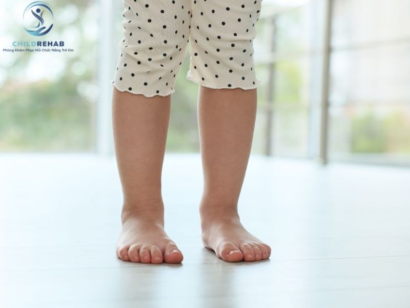 Những Hiểu Lầm Về Lệch Trục Chi Dưới Ở Trẻ Mà Phụ Huynh Hay Gặp 2026 | ChildRehab