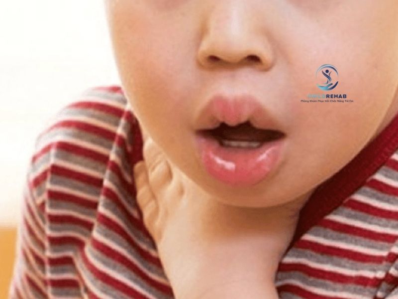Trẻ Khó Thở Có Nguy Hiểm Không? Góc Nhìn Chuyên Gia 2026 | ChildRehab