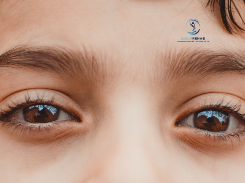 Vì Sao Một Số Trẻ Tránh Giao Tiếp Bằng Mắt? 2026 | ChildRehab
