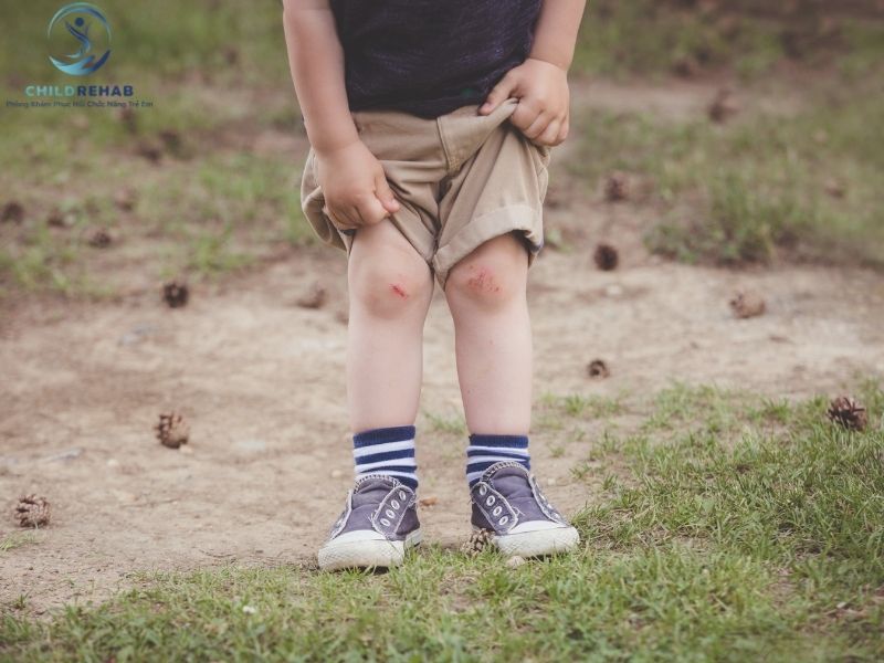 Hai Đầu Gối Không Cân Đối Khi Đứng Có Đáng Lo Không? 2026 | ChildRehab