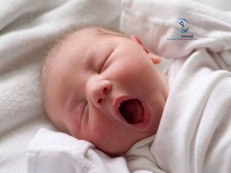 Trẻ Sinh Non Có Dễ Bị Khò Khè Không? 2026 | ChildRehab