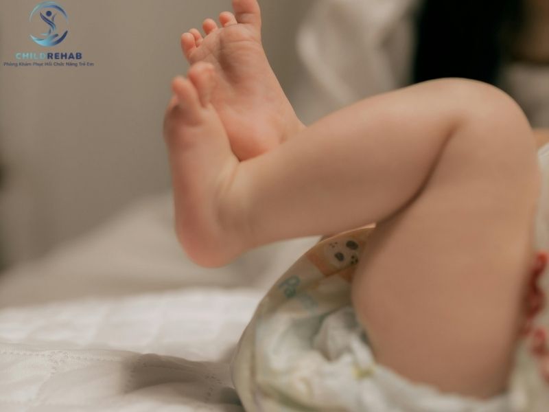 Phân Biệt Lệch Trục Chi Dưới Và Bàn Chân Bẹt Ở Trẻ 2026 | ChildRehab