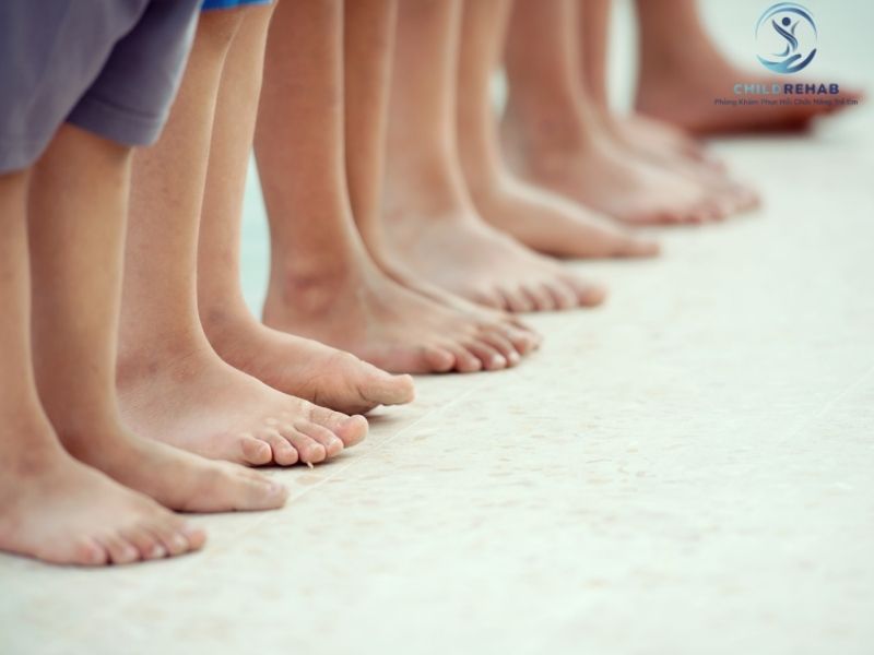 Lệch Trục Chi Dưới Có Liên Quan Đến Tư Thế Đứng Sai Ở Trẻ Không? 2026 | ChildRehab