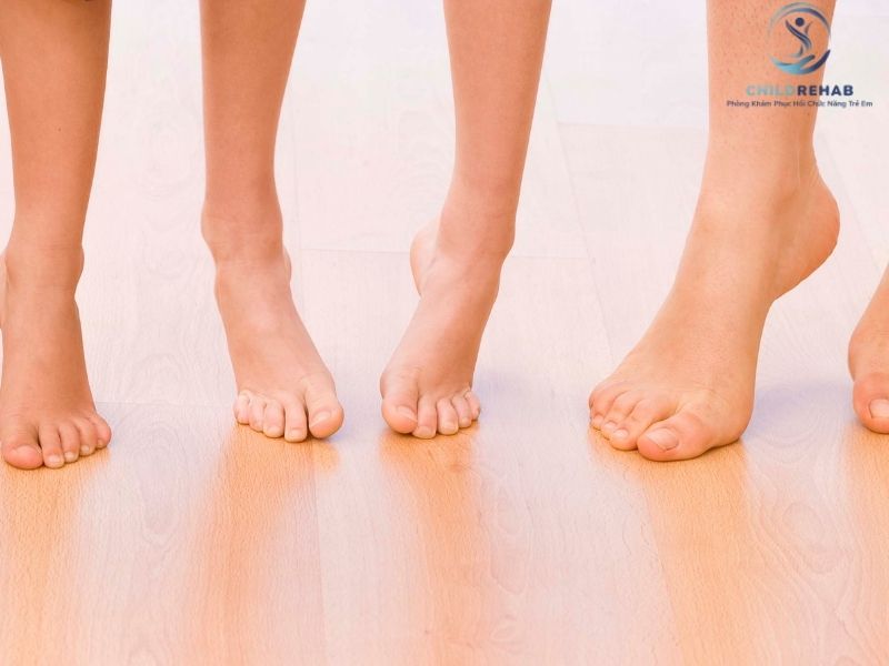 Nguyên Nhân Lệch Trục Chi Dưới Ở Trẻ Là Gì? 2026 | ChildRehab