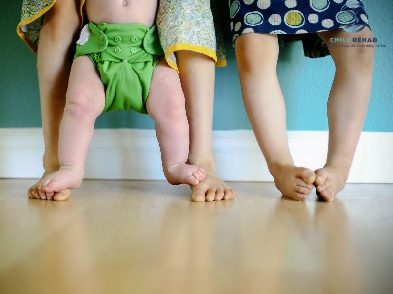 Lệch Trục Chi Dưới Ở Trẻ Có Phải Do Thiếu Canxi Không? 2026 | ChildRehab