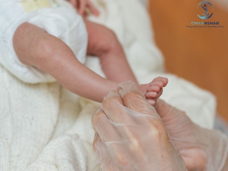 Can Thiệp Sớm Lệch Trục Chi Dưới Ở Trẻ Có Quan Trọng Không? 2026 | ChildRehab