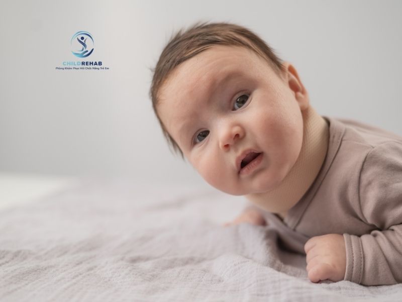 Vẹo Cổ Ở Trẻ Là Gì? Dấu Hiệu Nhận Biết Sớm 2026 | ChildRehab