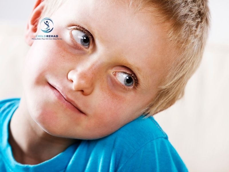 Vẹo Cổ Ở Trẻ Có Thể Phát Hiện Từ Mấy Tháng Tuổi? 2026 | ChildRehab