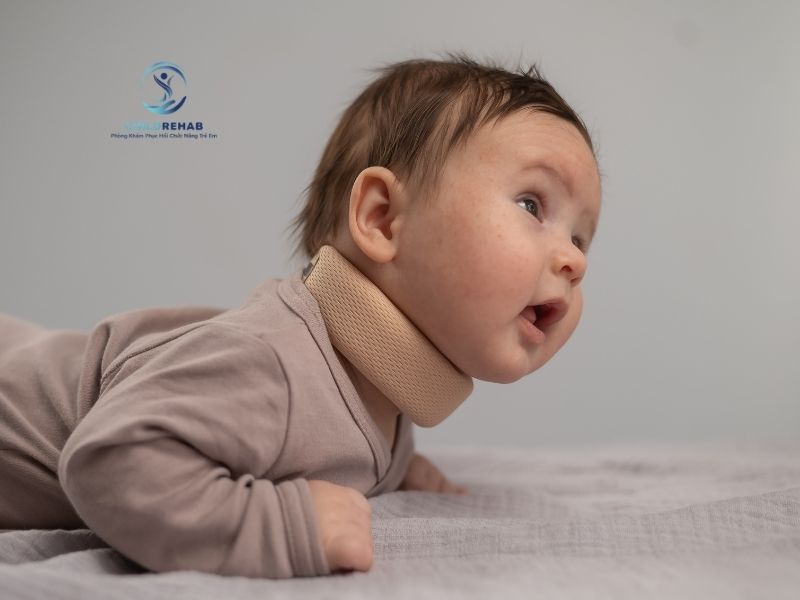 Vẹo Cổ Bẩm Sinh Ở Trẻ Là Gì? 2026 | ChildRehab