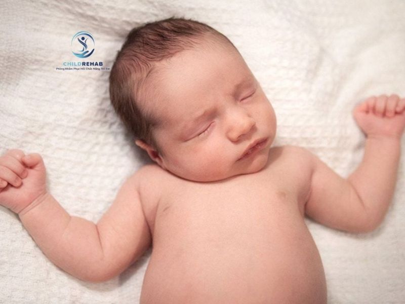 Trẻ Bị Vẹo Cổ Do Co Cứng Cơ Ức Đòn Chũm 2026 | ChildRehab