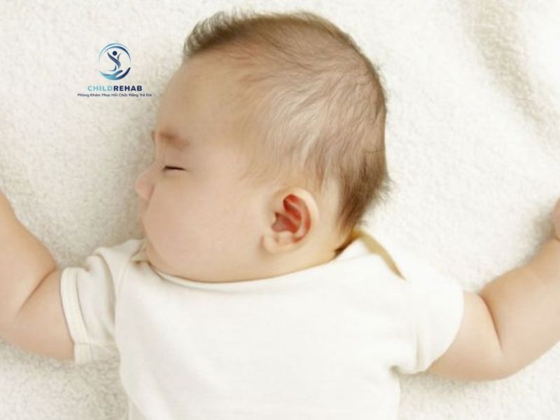 Trẻ Bị Vẹo Cổ Có Ảnh Hưởng Đến Khả Năng Tập Trung Không? 2026 | ChildRehab