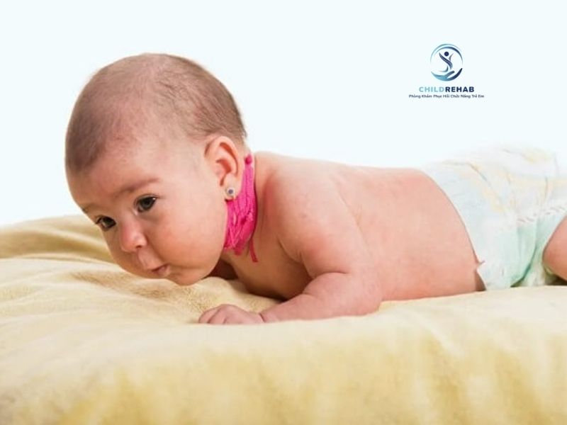 Vật Lý Trị Liệu Cho Trẻ Bị Vẹo Cổ Có Hiệu Quả Không? 2026 | ChildRehab