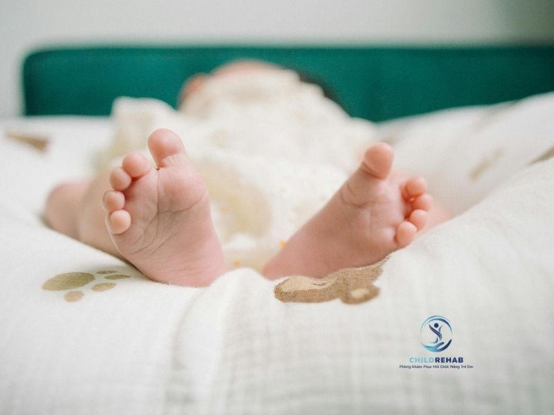 Bàn Chân Bẹt Ở Trẻ Là Gì? Dấu Hiệu Nhận Biết Sớm 2026 | ChildRehab