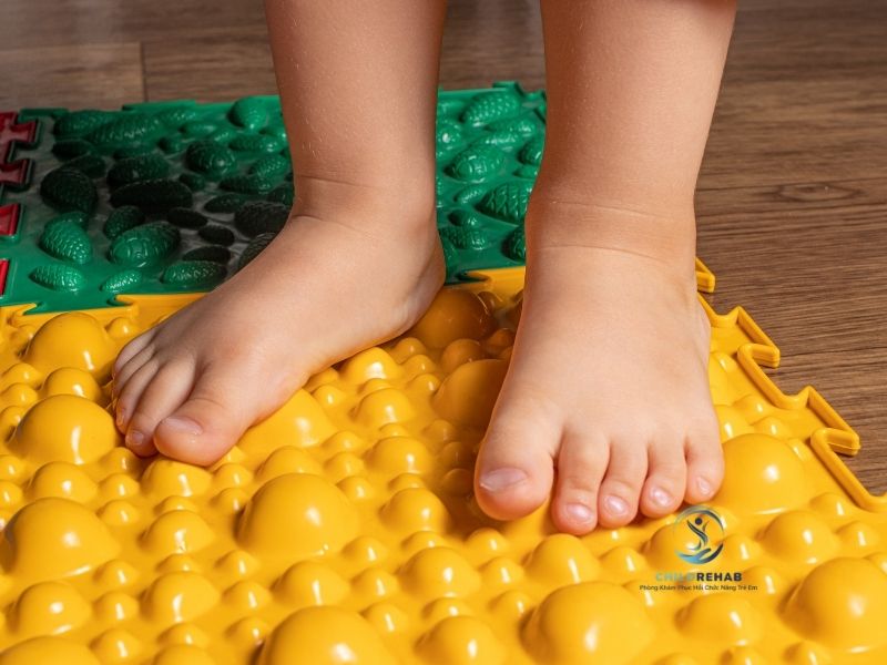 Dấu Hiệu Trẻ Bị Bàn Chân Bẹt Phụ Huynh Dễ Bỏ Qua 2026 | ChildRehab