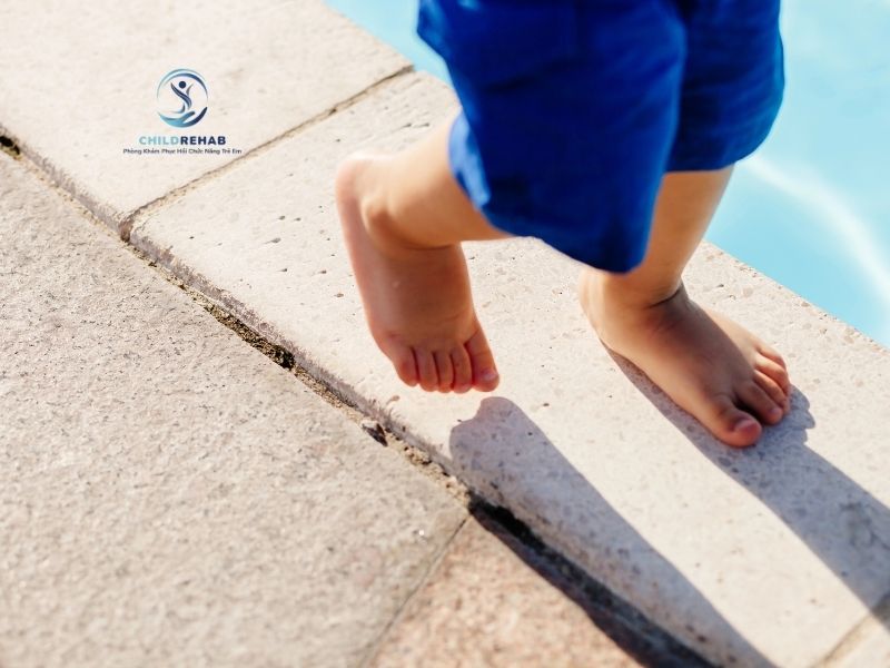 Nguyên Nhân Trẻ Bị Bàn Chân Bẹt Phổ Biến Nhất 2026 | ChildRehab