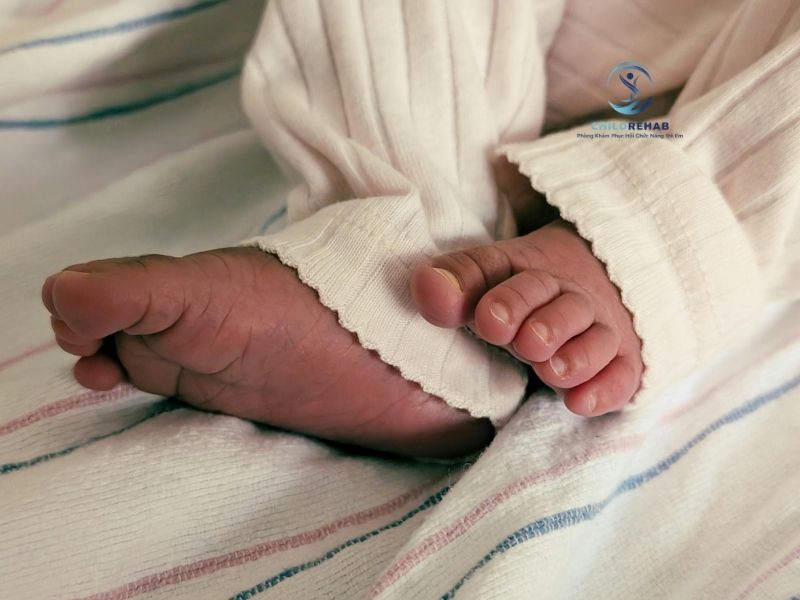 Trẻ Bị Bàn Chân Bẹt Do Dây Chằng Lỏng Có Đúng Không? 2026 | ChildRehab