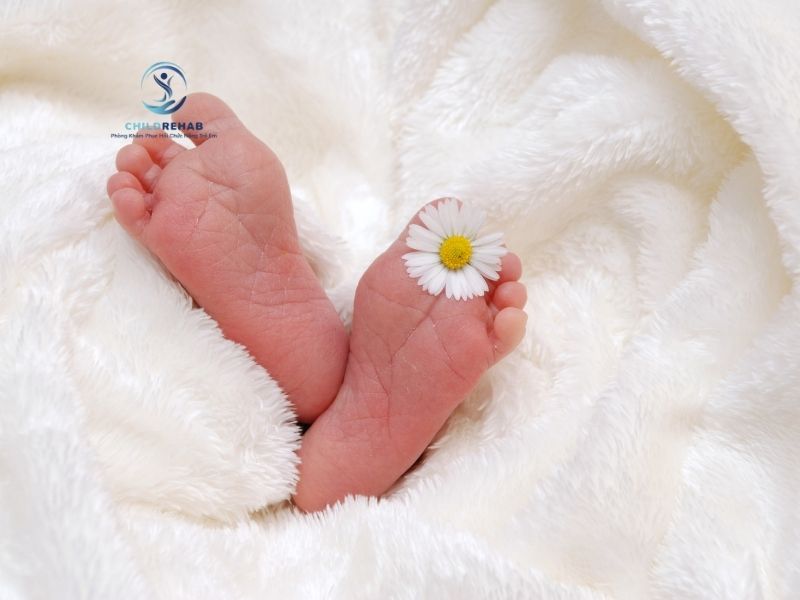 Các Mức Độ Bàn Chân Bẹt Ở Trẻ Em 2026 | ChildRehab