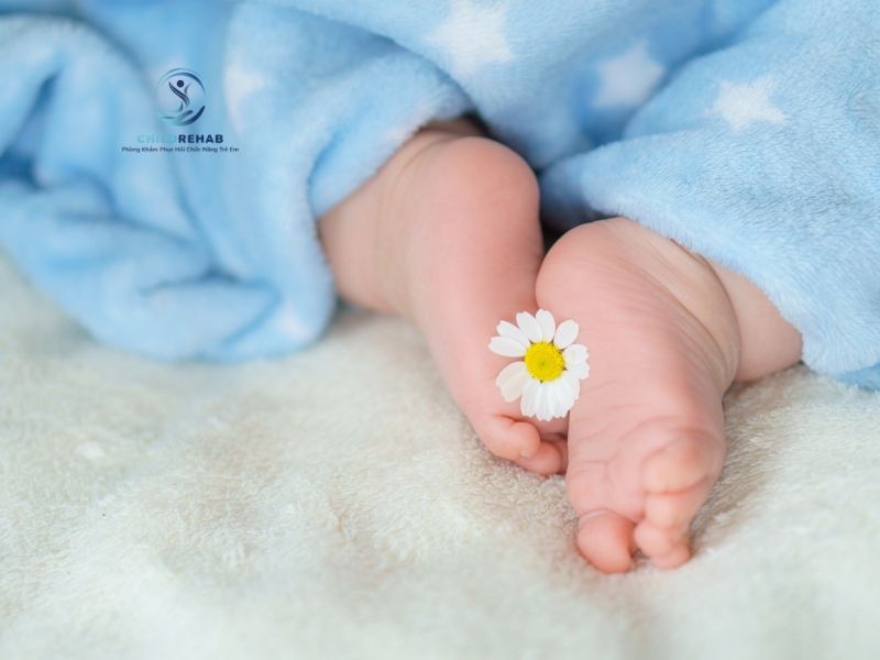 Bàn Chân Bẹt Mềm Và Bàn Chân Bẹt Cứng Ở Trẻ Khác Nhau Thế Nào? 2026 | ChildRehab