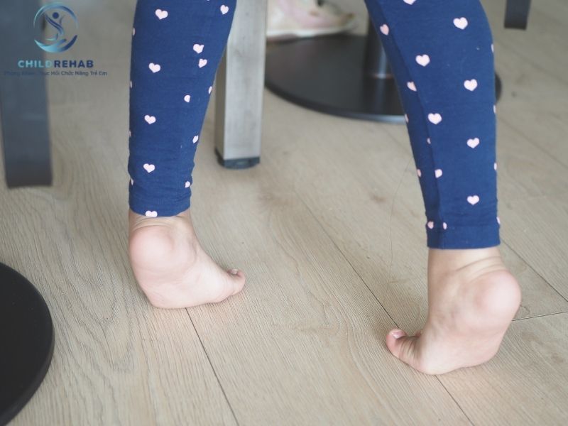 Dấu Hiệu Trẻ Đi Bằng Mũi Chân Phụ Huynh Có Thể Nhận Biết Sớm 2026 | ChildRehab