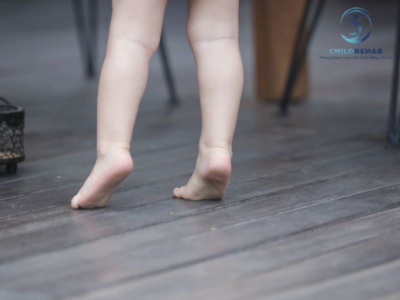 Trẻ Đi Không Chạm Gót Có Phải Là Đi Bằng Mũi Chân Không? 2026 | ChildRehab