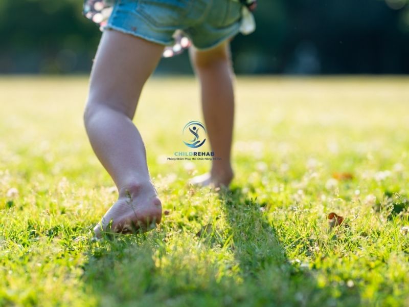 Chân Chữ X Nhẹ Ở Trẻ Có Cần Lo Không? Khi Nào Nên Theo Dõi, Khi Nào Nên Can Thiệp 2026 | ChildRehab