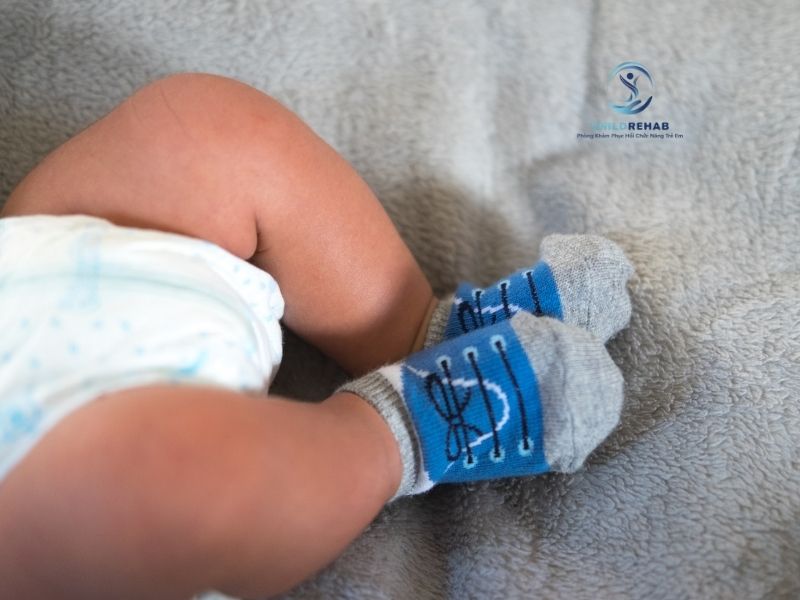 Chân Chữ X Ở Trẻ Có Phải Do Thiếu Canxi Không? 2026 | ChildRehab