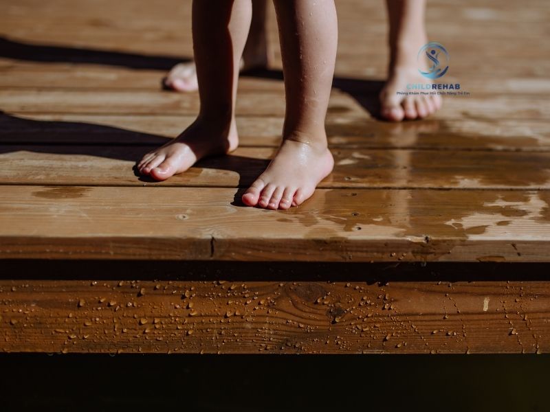 Trẻ Thừa Cân Có Dễ Bị Chân Chữ X Hơn Không? 2026 | ChildRehab