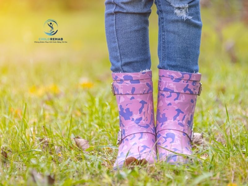 Chân Chữ X Ở Trẻ Có Liên Quan Đến Cấu Trúc Xương Và Khớp Không? 2026 | ChildRehab