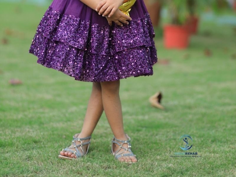 Chân Chữ X Ở Trẻ 5 Tuổi Và Những Dấu Hiệu Không Nên Chủ Quan 2026 | ChildRehab