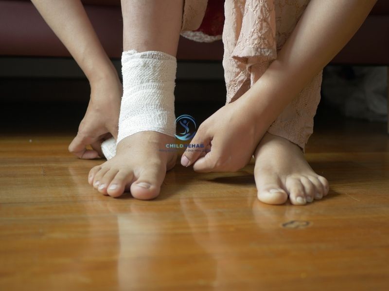 Đánh Giá Chân Chữ X Ở Trẻ Gồm Những Gì? 2026 | ChildRehab