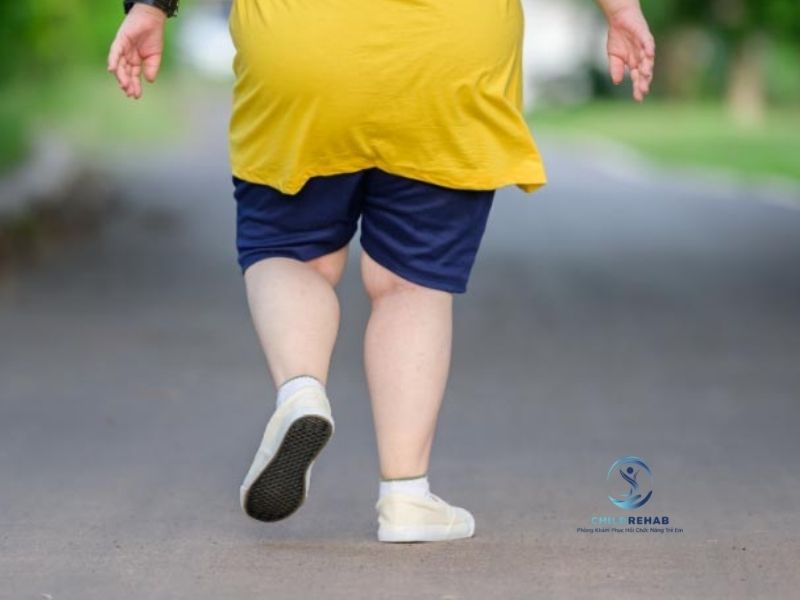 Trẻ Bị Chân Chữ X Nên Tập Gì? Gợi Ý Các Hoạt Động Hỗ Trợ Phù Hợp 2026 | ChildRehab