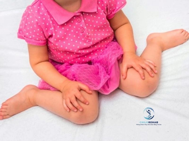 Trẻ Bị Chân Chữ X Có Nên Ngồi Kiểu Chữ W Không? 2026 | ChildRehab