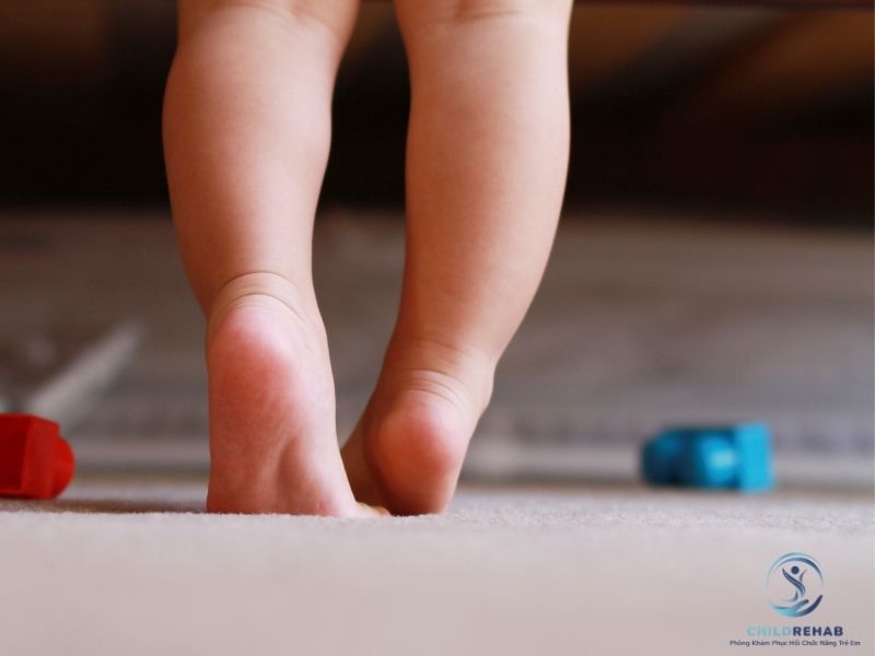 Con Tôi Chỉ Đi Nhón Chân Khi Đi Chân Trần, Có Đáng Lo Không? 2026 | ChildRehab