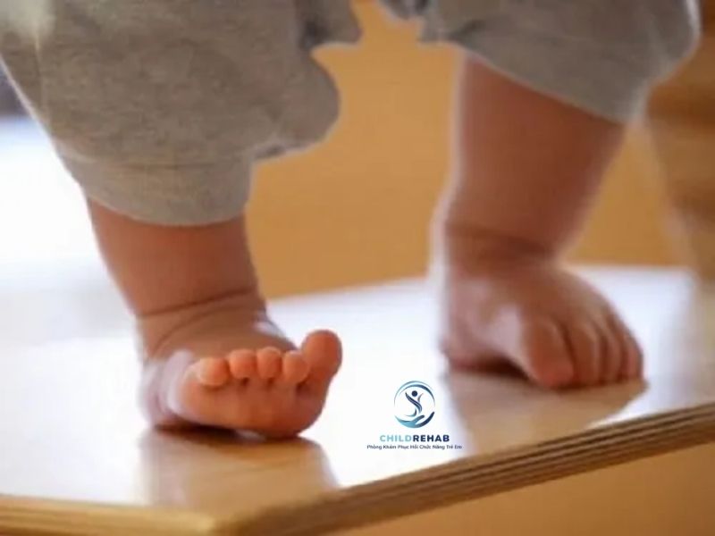 Chân Chữ O Nhẹ Ở Trẻ Có Cần Lo Không? 2026 | ChildRehab