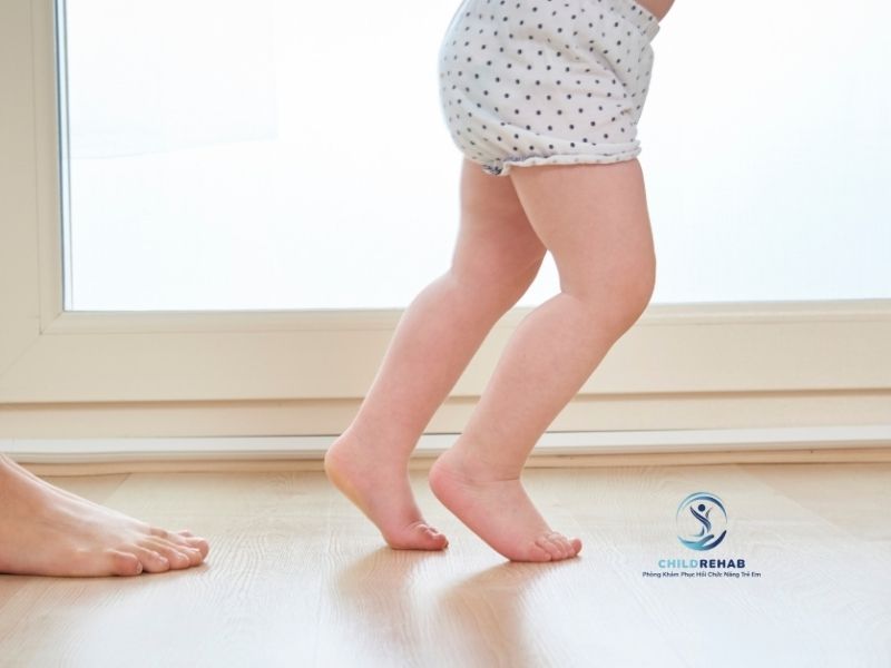 Dáng Đi Của Trẻ Bị Chân Chữ O Có Gì Khác Thường? 2026 | ChildRehab