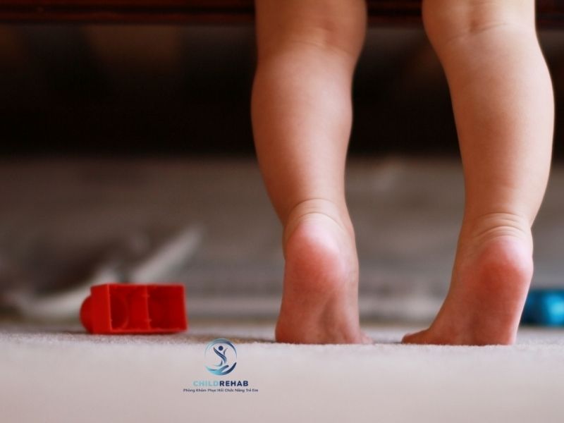 Hai Đầu Gối Của Trẻ Không Khép Lại Được Có Đáng Lo Không? 2026 | ChildRehab