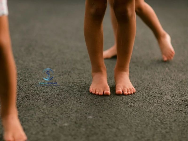 Chân Chữ O Ở Trẻ 4 Tuổi Có Còn Bình Thường Không? 2026 | ChildRehab