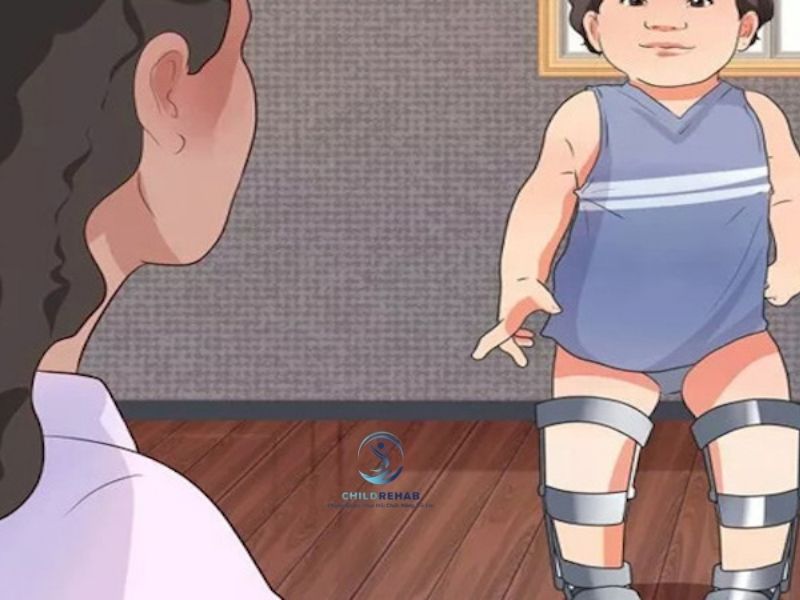 Cách Hỗ Trợ Trẻ Bị Chân Chữ O Tại Nhà Phụ Huynh Nên Biết 2026 | ChildRehab